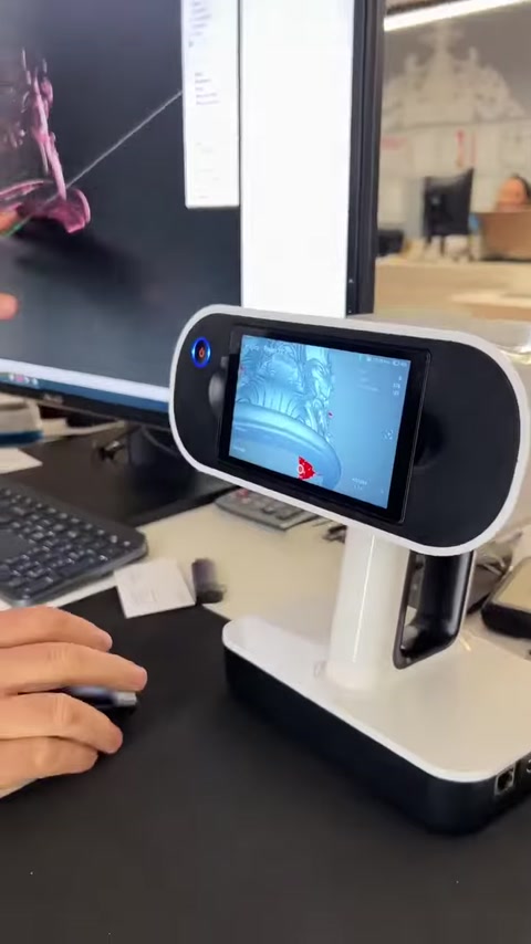 I dati della superficie acquisiti sono visualizzati sullo schermo dello scanner 3D